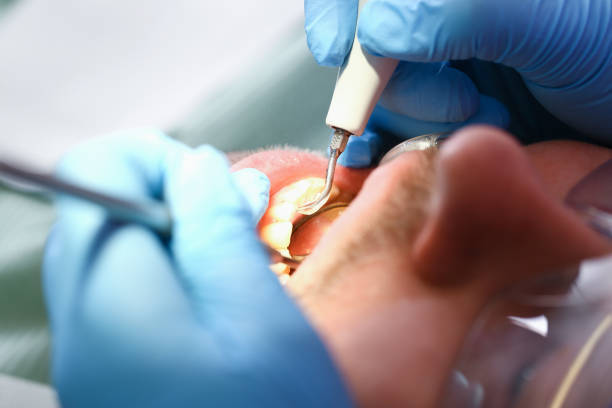 Emergency Gum Pain Relief in NM