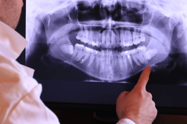 Best Dentist for Severe Toothache  in Chama, NM