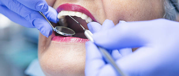 Best Emergency Gum Pain Relief  in Chama, NM